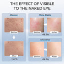 Máscara facial LED con terapia de luz roja para La cara y la piel - additional image 2